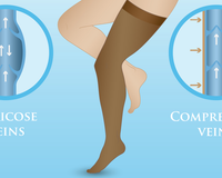 Bas de Contention : Comment Ça Marche et Quels Bienfaits ? - my contention